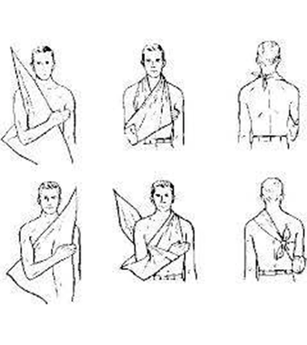 LINE2Design Medical Triangular Bandages Emergency First Aid - Image 3